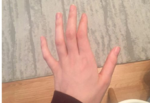 OBAVEZNO OBRATITE PAŽNJU: Ako vam trnu prsti, to može da znači nekoliko stvari, a ovo je uzrok