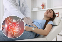 Četiri najčešća znaka upale slepog creva: Ne odlažite pregled, brza dijagnoza spašava život