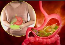 10 namirnica koje izazivaju gasove i nadutost: Pasulj jeste glavni, ali ne i jedini krivac