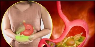 10 namirnica koje izazivaju gasove i nadutost: Pasulj jeste glavni, ali ne i jedini krivac