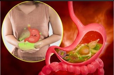 10 namirnica koje izazivaju gasove i nadutost: Pasulj jeste glavni, ali ne i jedini krivac