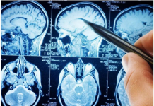 POVRĆE JE TOLIKO ZDRAVO DA O NJEMU PIŠE NJUJORK TAJMS: Amerikanci daju po 30 dolara za jedan list, a ono raste kod nas