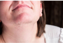 EVO ZAŠTO ŽENE IMAJU DLAKAVU BRADU! Ovo vam organizam govori!