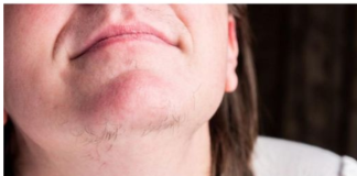 EVO ZAŠTO ŽENE IMAJU DLAKAVU BRADU! Ovo vam organizam govori!