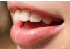 Krvarenje desni može biti znak da vam nedostaje jedna važna stvar