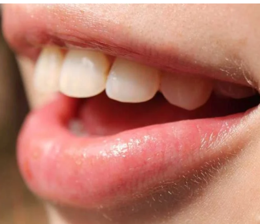 Krvarenje desni može biti znak da vam nedostaje jedna važna stvar