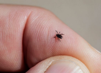 Počela je sezona krpelja, evo kako se zaštiti i kako ga odstraniti iz kože