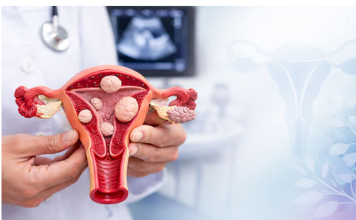 Žene obratite pažnju: Ovo su prvi simptomi mioma materice, obično ih je više, a ovi su najčešći