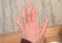 OBAVEZNO OBRATITE PAŽNJU: Ako vam trnu prsti, to može da znači nekoliko stvari, a ovo je uzrok