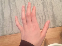 OBAVEZNO OBRATITE PAŽNJU: Ako vam trnu prsti, to može da znači nekoliko stvari, a ovo je uzrok