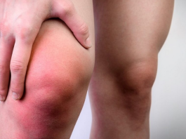 Nanesite ovo ulje na koljena prije spavanja. Za 7 dana osjetit ćete razliku