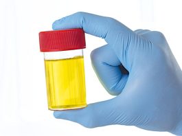 ZAŠTO IMATE JAK I NEPRIJATAN MIRIS URINA: Ovaj znak organizma ne smijete zanemariti! EVO NA ŠTA VAS UPOZORAVA