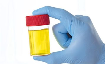 ZAŠTO IMATE JAK I NEPRIJATAN MIRIS URINA: Ovaj znak organizma ne smijete zanemariti! EVO NA ŠTA VAS UPOZORAVA