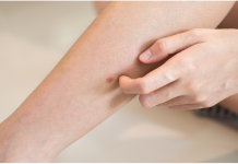 „Šta uzrokuje svrab na različitim dijelovima tijela: kada je bezopasan, a kada potražiti savjet ljekara“