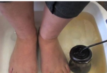 NEVJEROJATNI REZULTATI NAMAKANJA STOPALA U JABUČNOM OKTU: ISPROBAJTE OVU JEDNOSTAVNU METODU