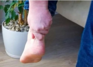 3 ZNAKA VISOKOG HOLESTEROLA: Odmah pogledajte vaše ruke i noge