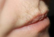 Dlačice iznad usana ovako će zauvijek nestati: Trik u koji se kunu milioni žena