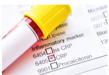 Šta znači povišen crp? Evo šta kaže doktorica, upozorenje: 2 važne stvari ljudi nemaju u kući…