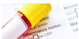 Šta znači povišen crp? Evo šta kaže doktorica, upozorenje: 2 važne stvari ljudi nemaju u kući…